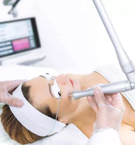 Feld Laser Rejuvenation