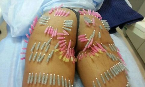 Hënneschten opgehuewe